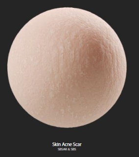 skin_acne_scar.png