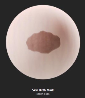 skin_birth_mark.png