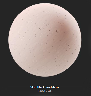 skin_blackhead_acne.png