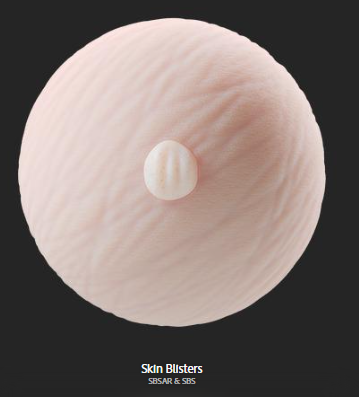 skin_blisters.png