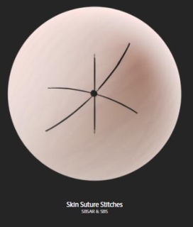 skin_suture_stitches.png