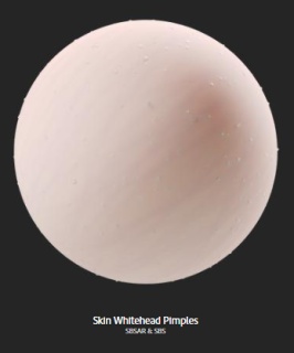 skin_whitehead_pimples.png